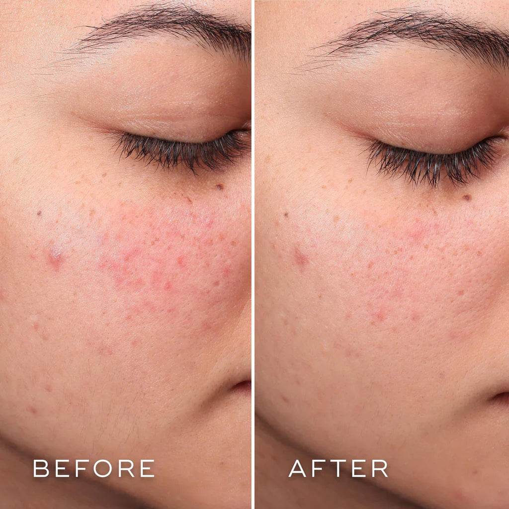 Press & Clear toner
