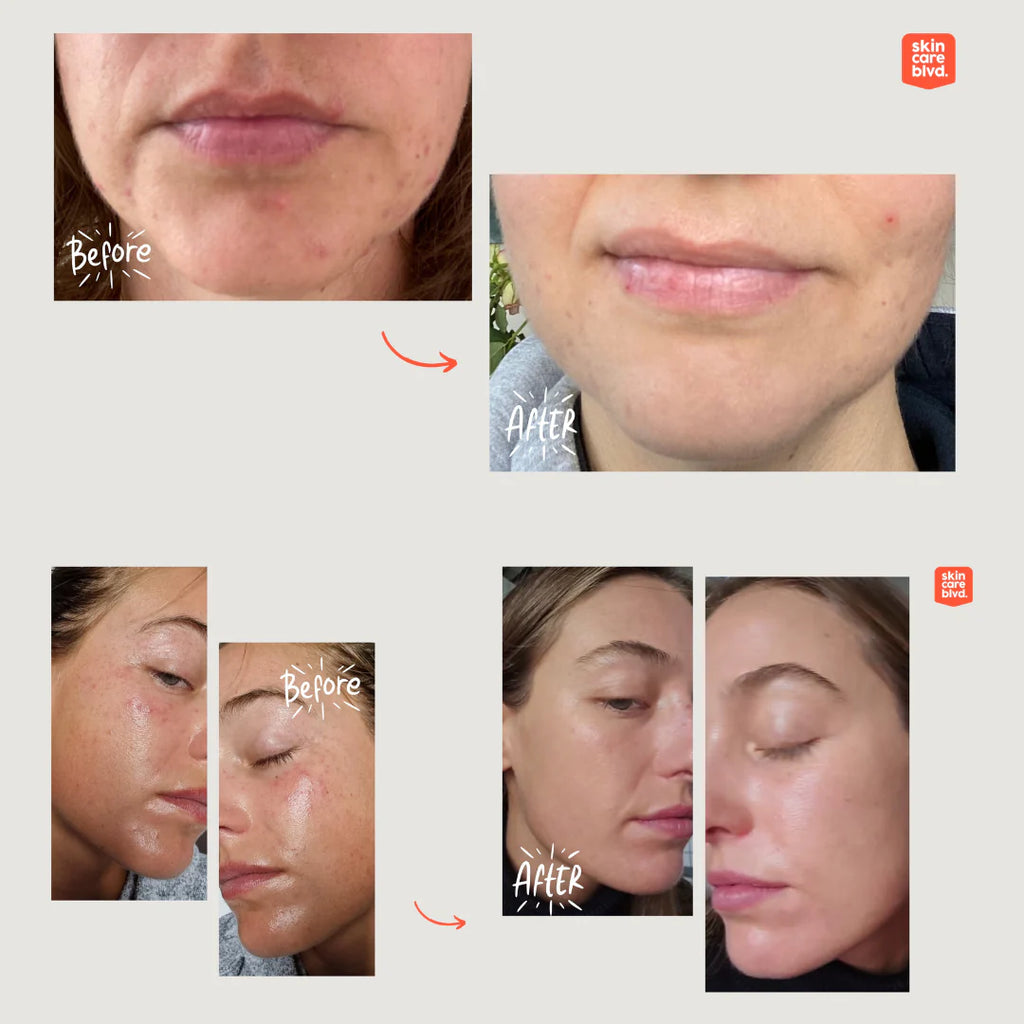 Synbiotic Skin Serum