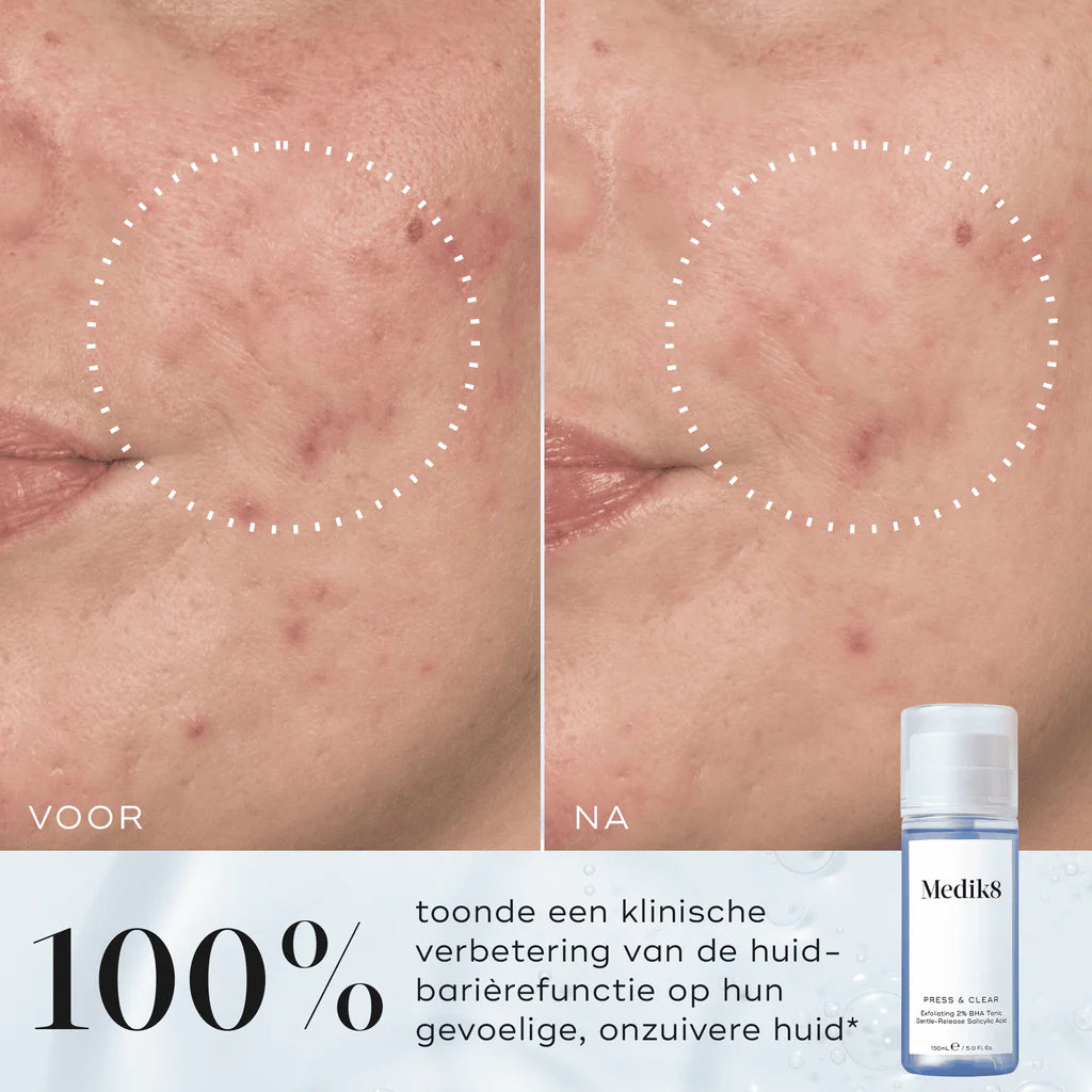 Press & Clear toner