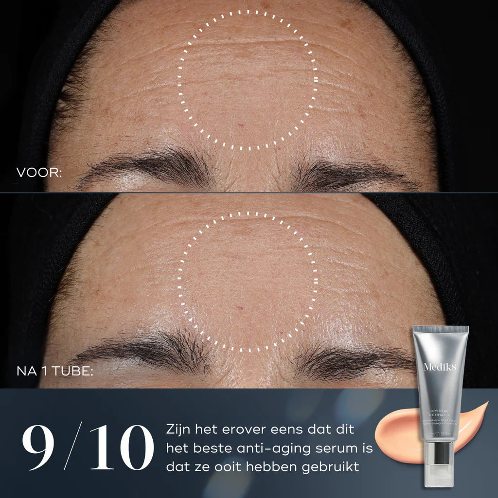 Crystal Retinal 10